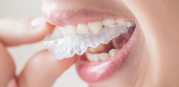 Blanqueamiento At Home