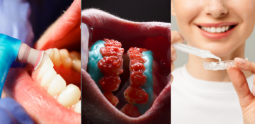 Resultado Sonrisa Brillante