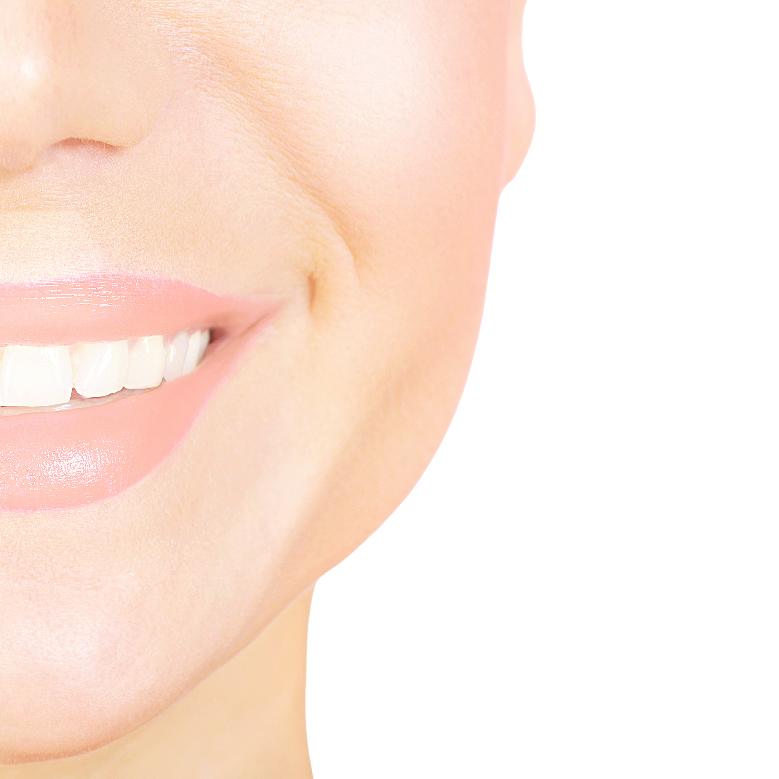 Resultado Limpieza Dental