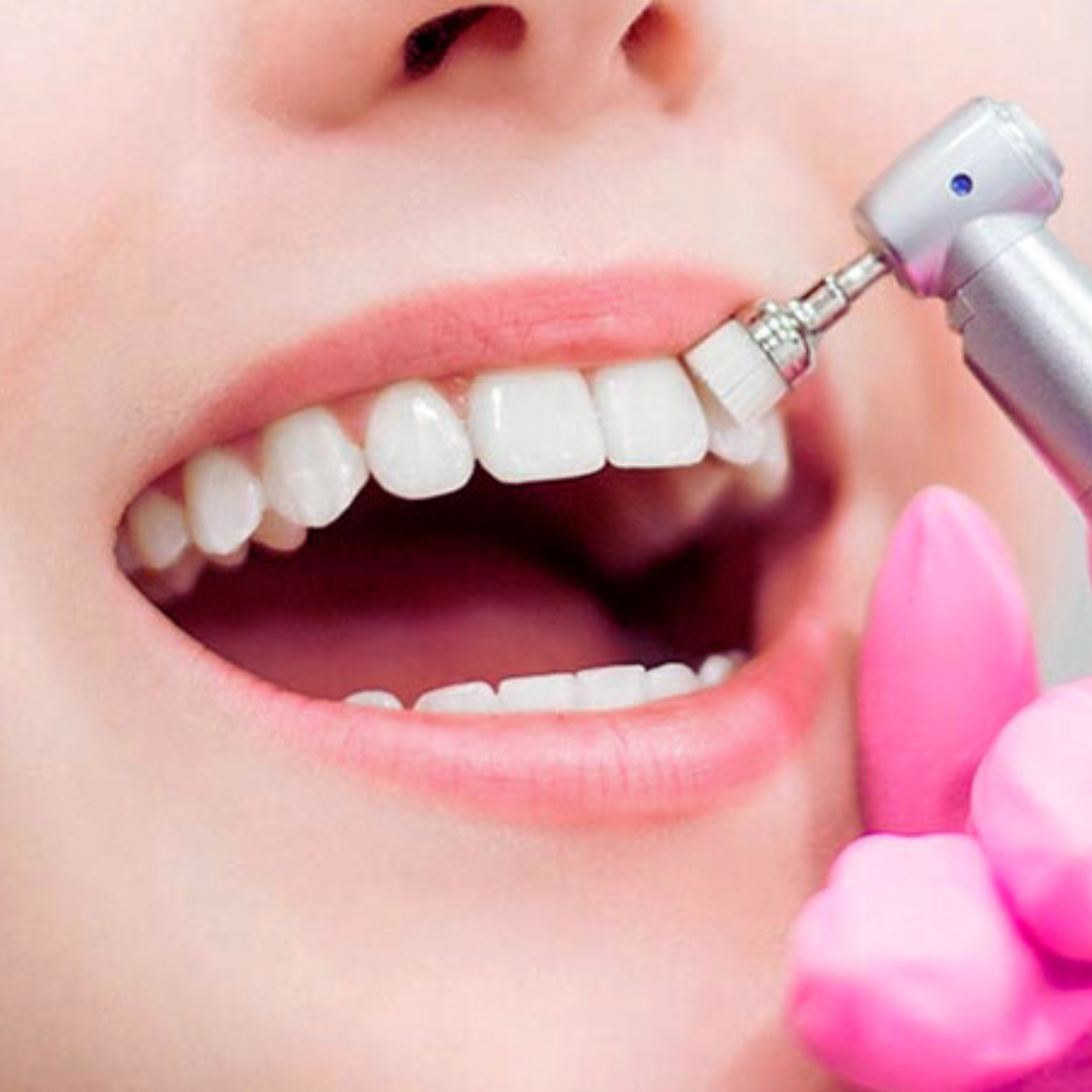 Valoración Dental Profunda